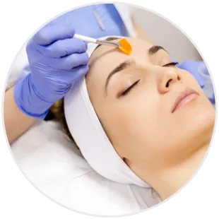 Peeling dermatologiczny